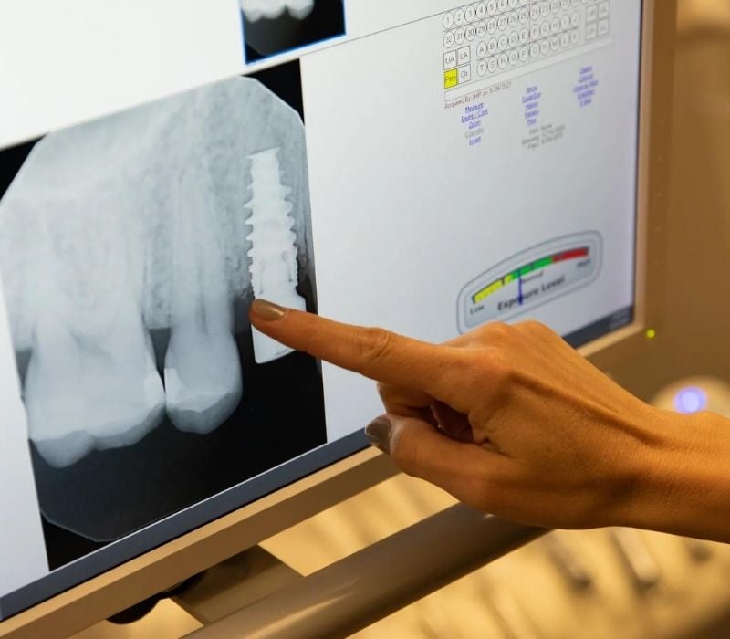Expertise Dental Welcome to Expertise Dental Implant Dentistry